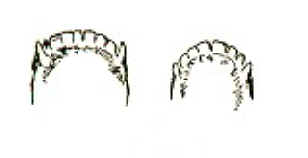 lowerjaw.jpg (3160 bytes)